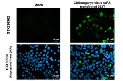 Anti-Chikungunya virus nsP2 antibody [HL1488] used in Immunocytochemistry/ Immunofluorescence (ICC/IF). GTX636962